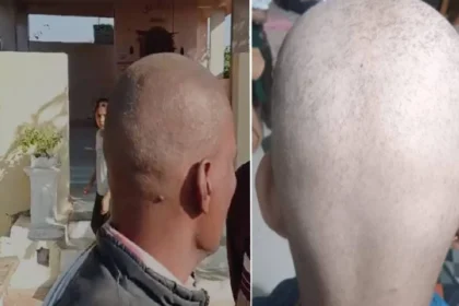 बुलढाण्यातील लोक टकले का झाले? कारण वाचून तुम्हीही सावध व्हा