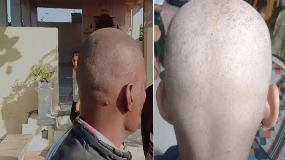 बुलढाण्यातील लोक टकले का झाले? कारण वाचून तुम्हीही सावध व्हा